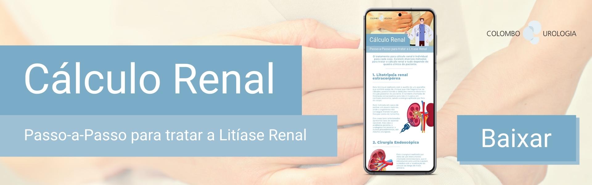 calculo renal