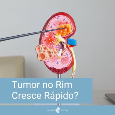 Tumor no Rim Cresce Rápido?