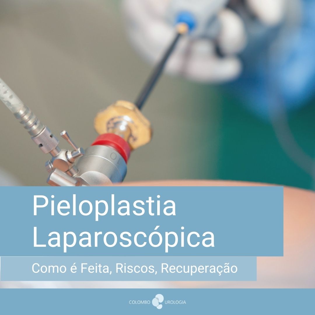 pieloplastia laparoscopica