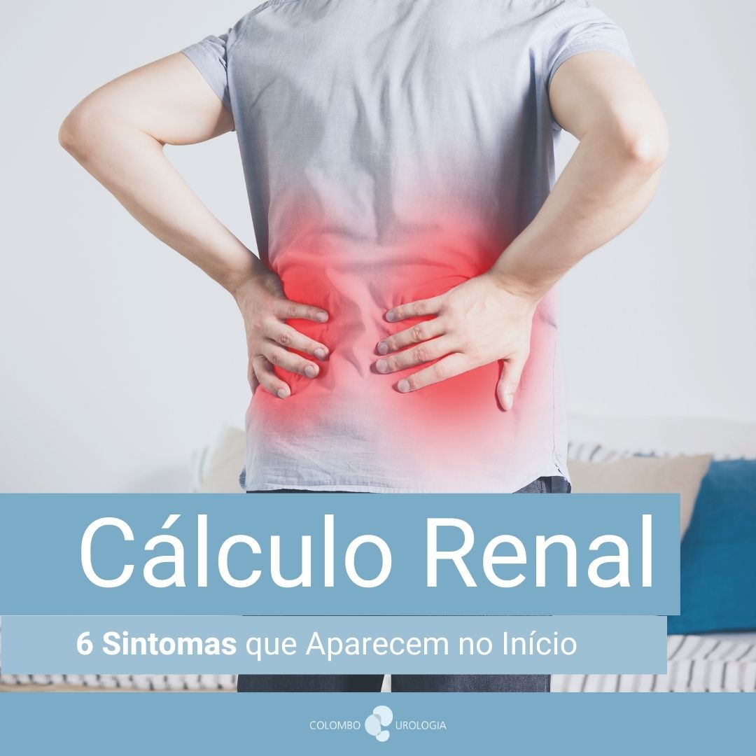 Cálculo Renal Sintomas