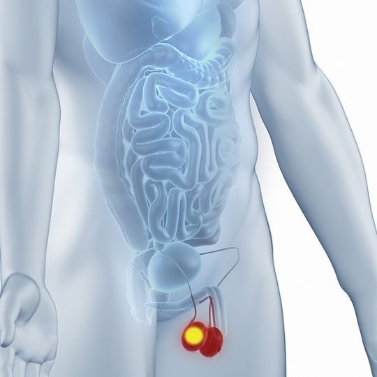 Câncer de testículos