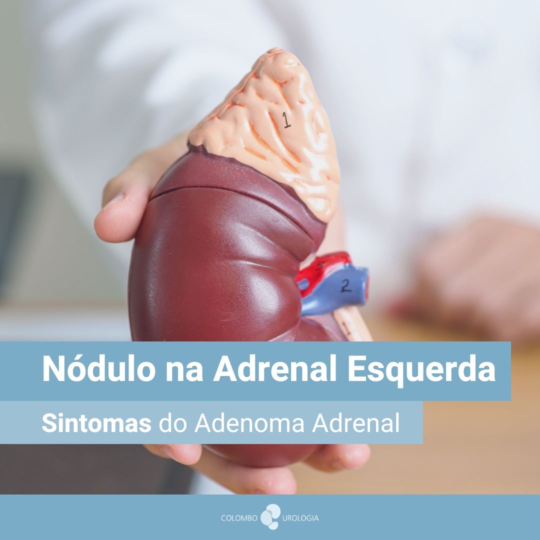 Nódulo na Adrenal Esquerda Sintomas