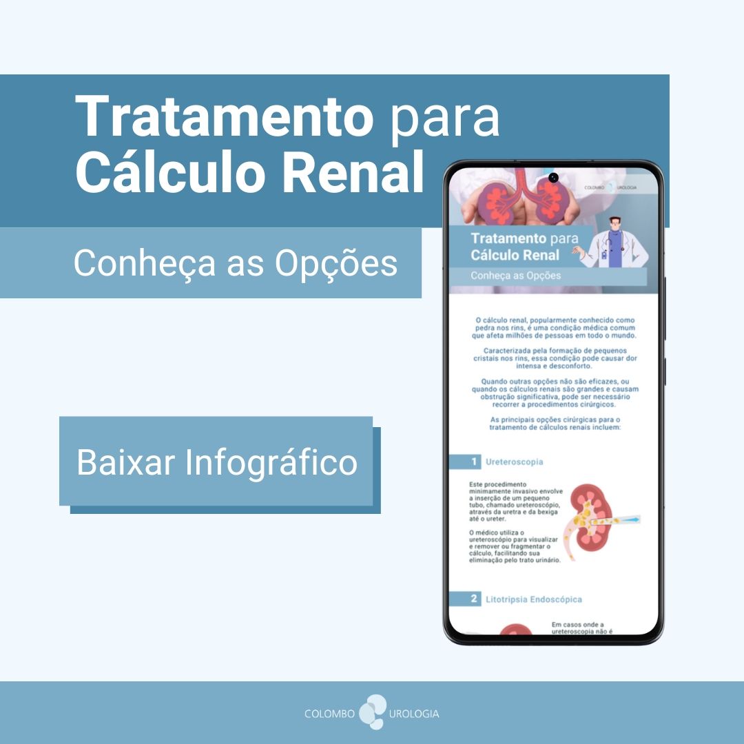 tratamento calculo renal