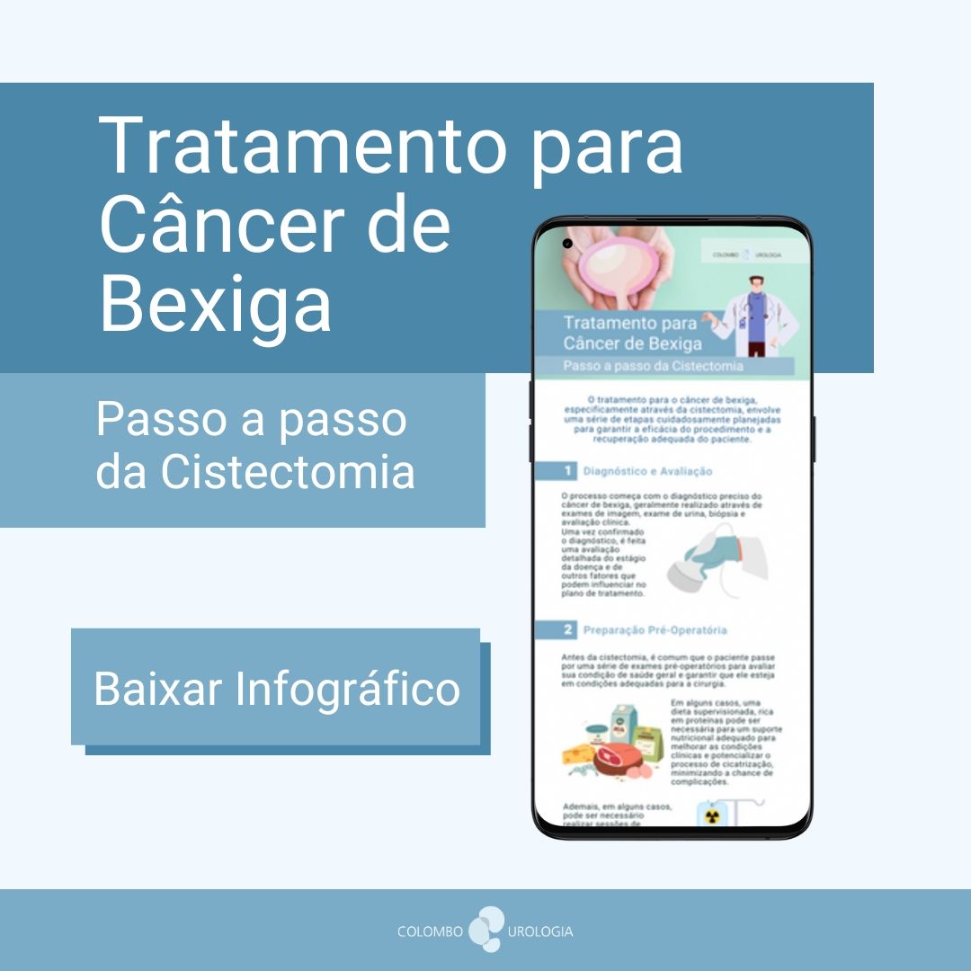 Tratamento para Câncer de Bexiga